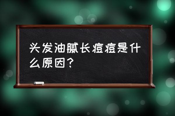 头发油脸上会长痘痘吗 头发油腻长痘痘是什么原因？