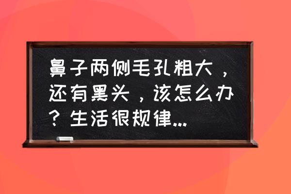 毛孔粗大黑头多还有救么 鼻子两侧毛孔粗大，还有黑头，该怎么办？生活很规律，饮食清淡？